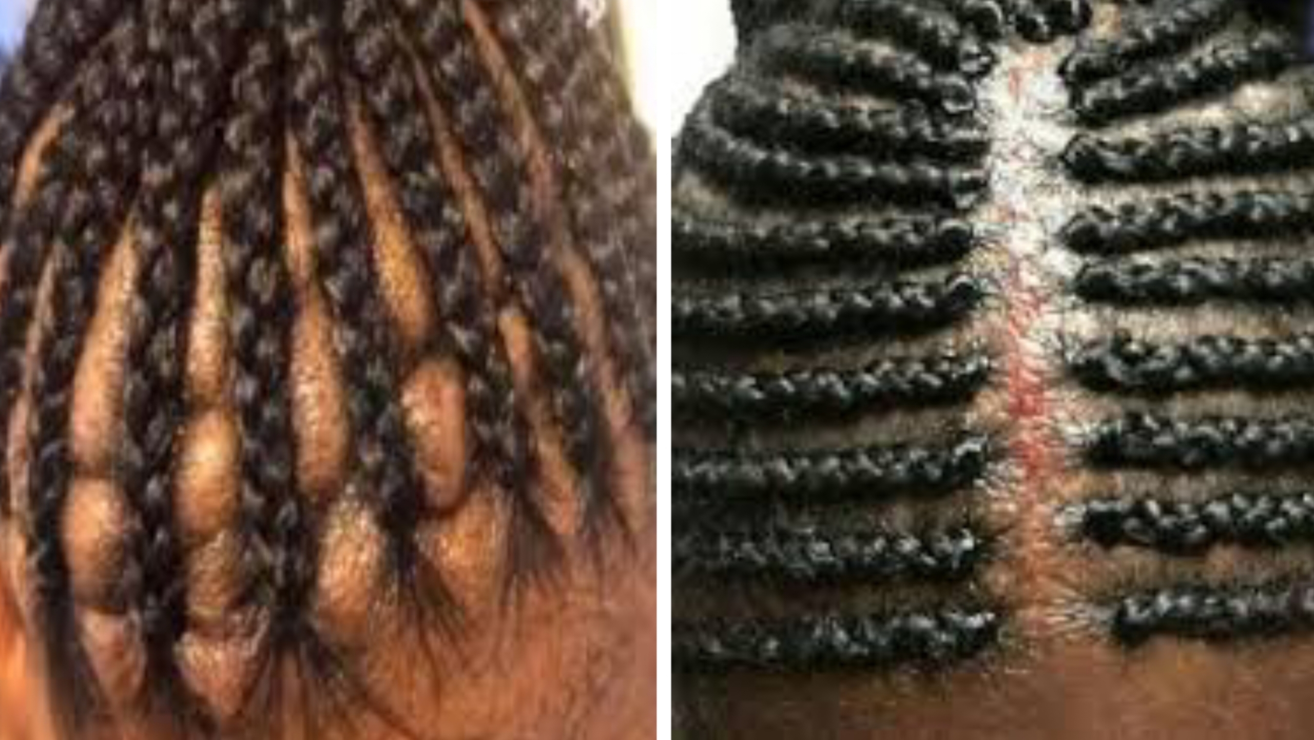 How to prevent your braided hairstyles from breakage and damage