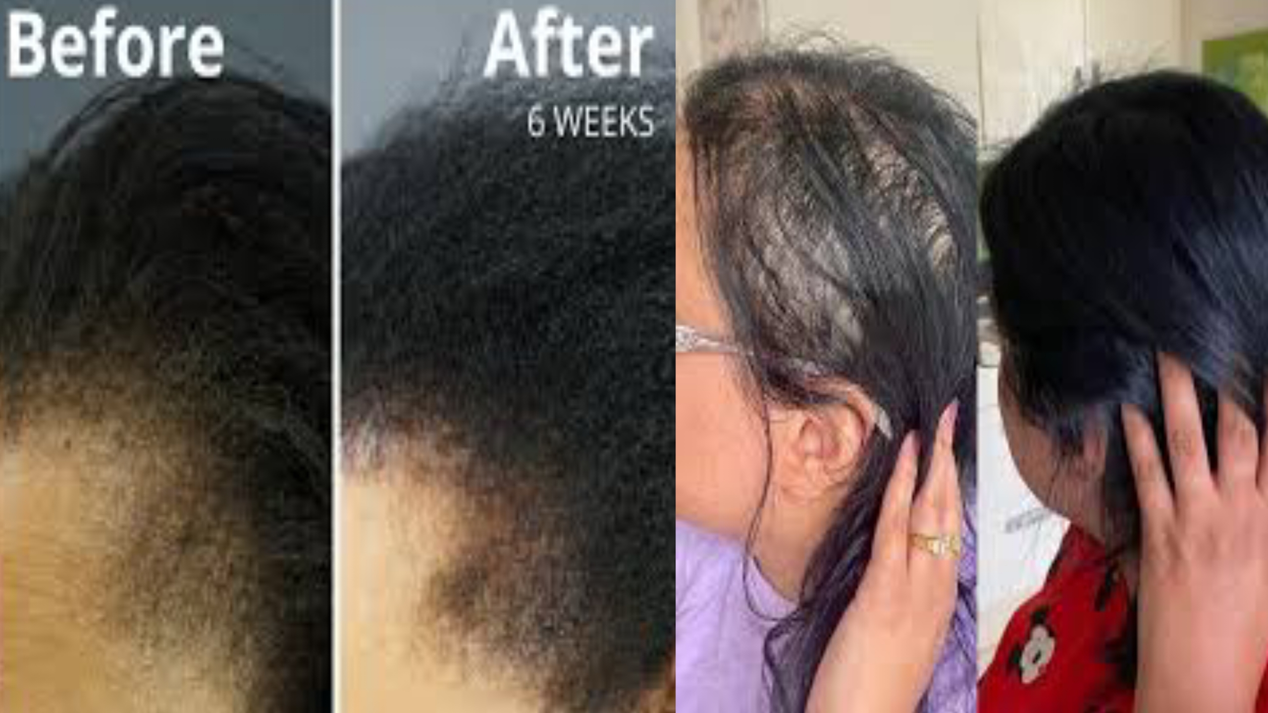 Best Natural Oils for Hair – And How to Use Them for Growth and Moisture